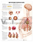 Hypertension Anatomical Chart